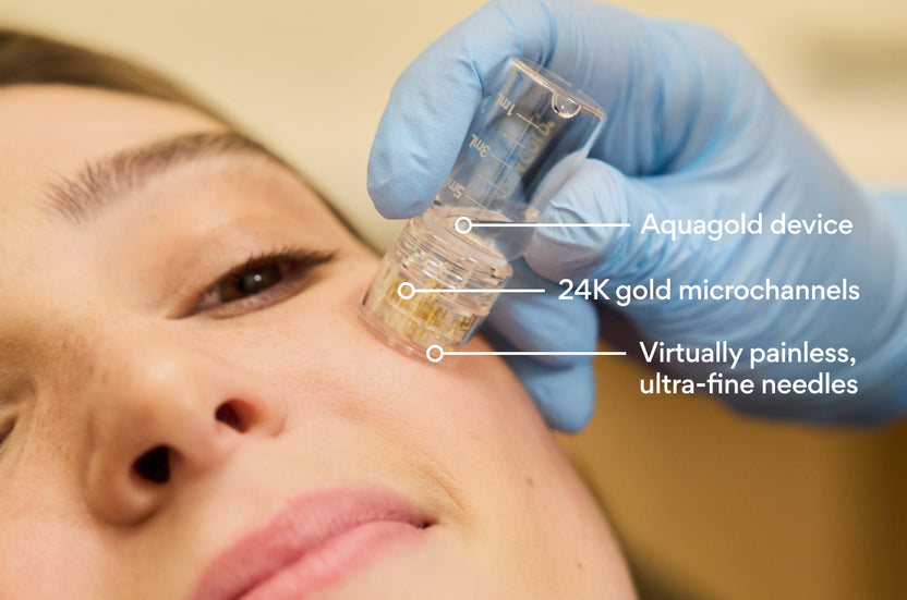 Botox Facial with Aquagold